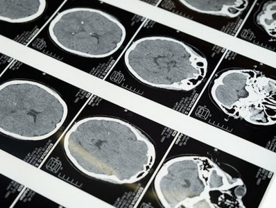 Нижегородские ученые создали уникальную систему тренировки мозга